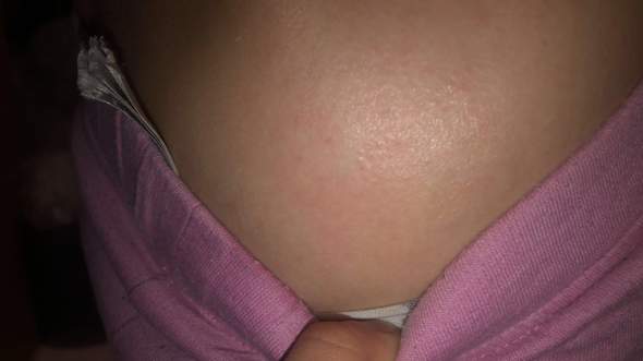 - (Gesundheit und Medizin, Juckreiz)