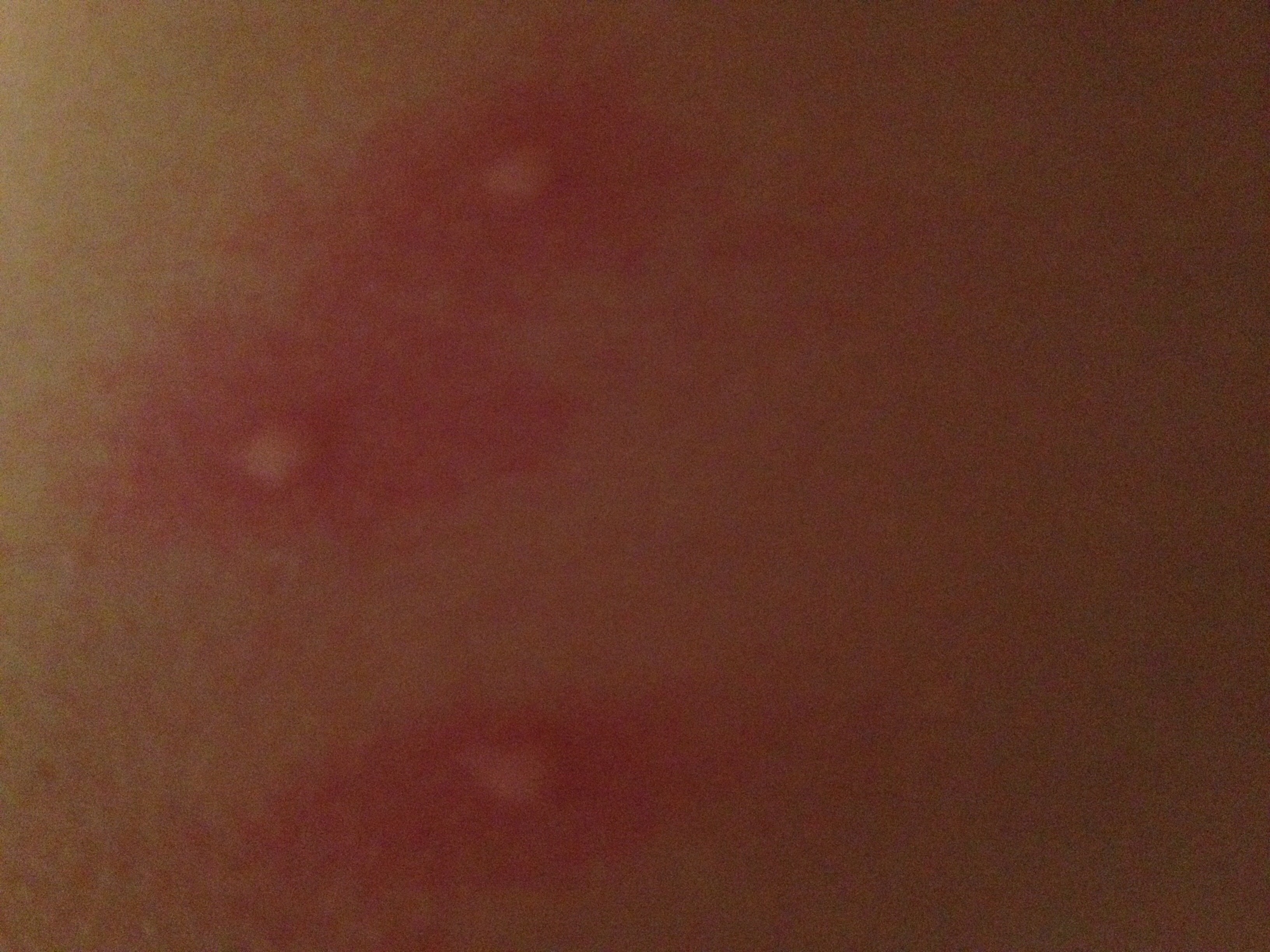 Rote Punkte Auf Dem Penis Kleine Rote Punkte Auf Der Eichel 2020 02 23 Rote Punkte Auf Dem Penis Kleine Rote Punkte Auf Der Eichel 2020 02 23