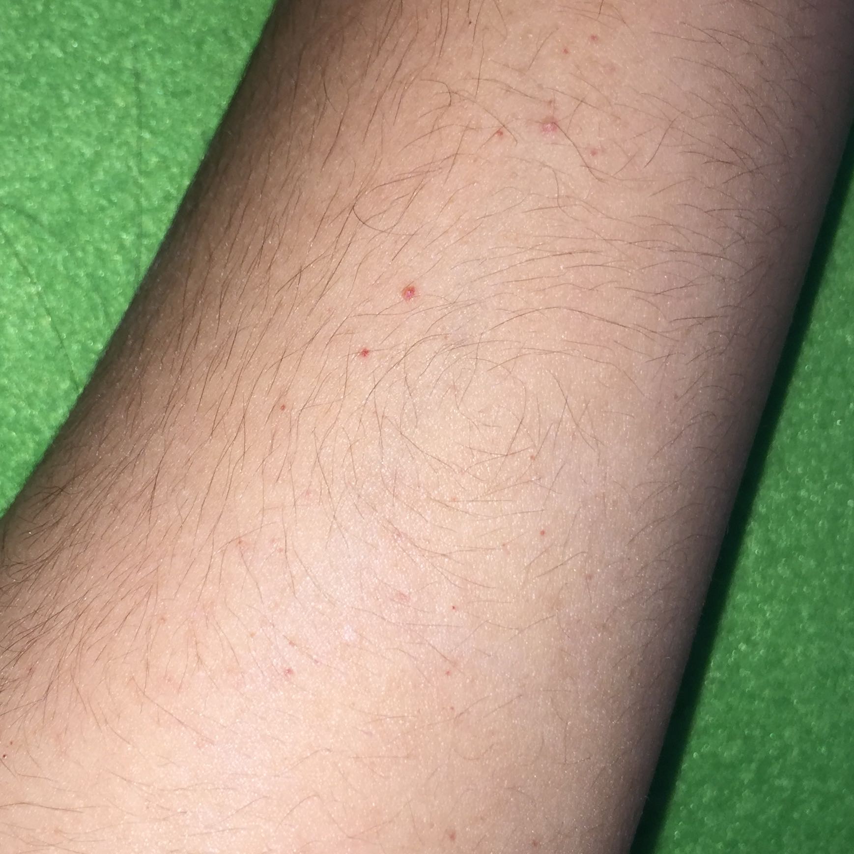 Rote kleine Punkte am arm? (Flecken) Rote kleine Punkte am arm? (Flecken)