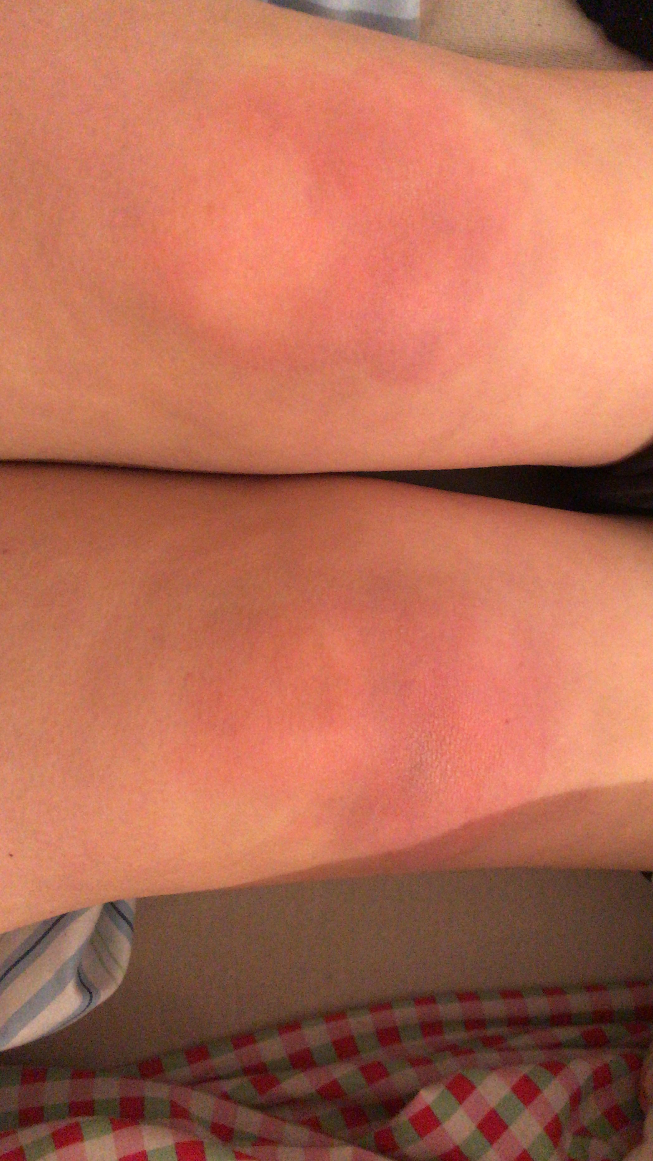 Rote Knie Ohne Grund Gesundheit Und Medizin Gesundheit Winter Rote Knie Ohne Grund Gesundheit Und Medizin Gesundheit Winter