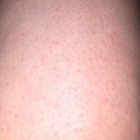 Beine, Punkte, Rasur, Hilfe, Mädchen  - (Mädchen, Pubertät, rasieren)