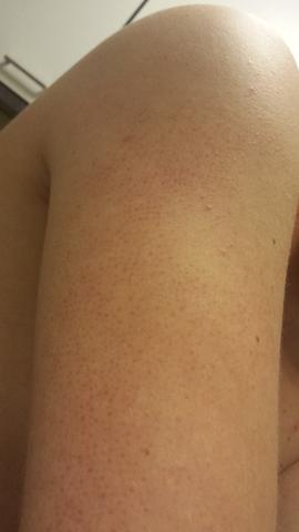 Mein Arm - (Gesundheit, Medizin, Körper)