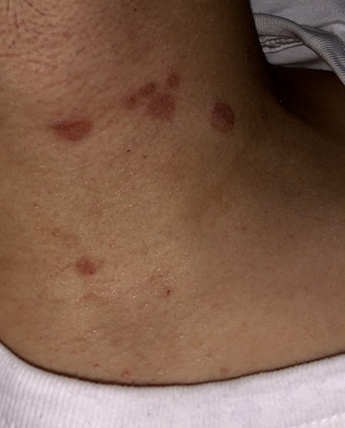 Rote Punkte Am Hals Wieso Gesundheit Medizin Hautpflege Rote Punkte Am Hals Wieso Gesundheit Medizin Hautpflege