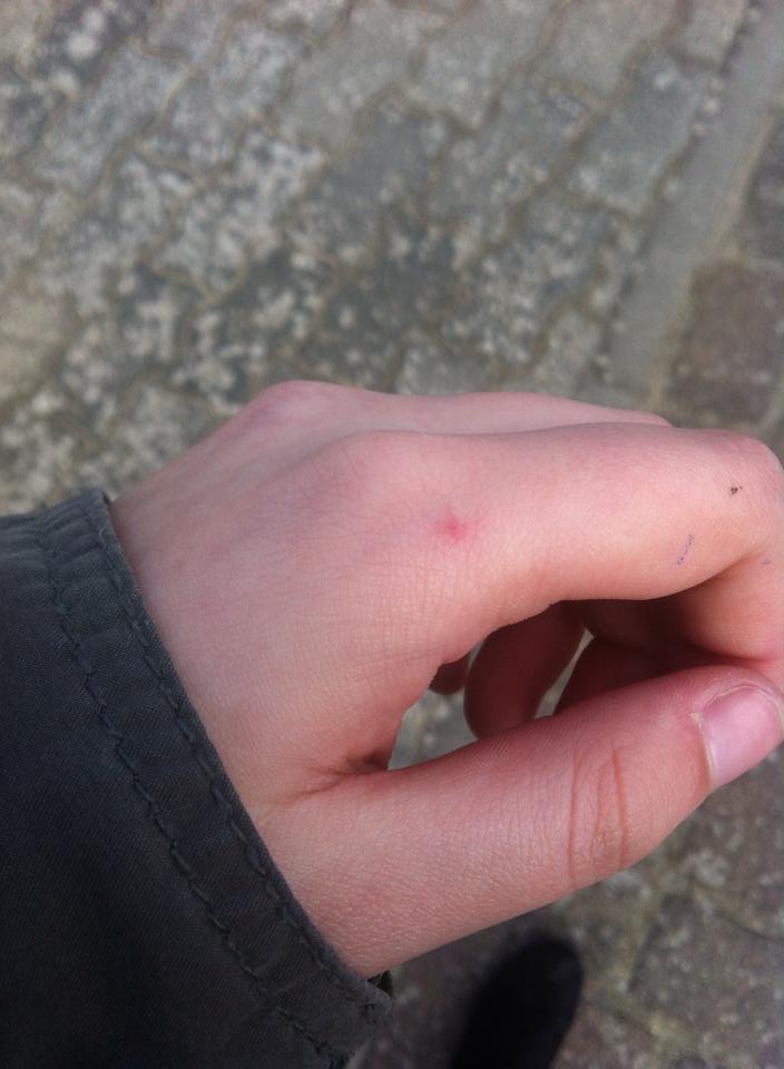 Punkte Auf Der Hand Punkte Auf Der Hand