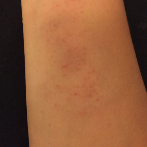 - (Gesundheit, Körper, Haut)