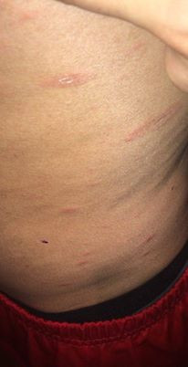 Bauch von der Seite (rechts) - (Hautpflege, rote-punkte)
