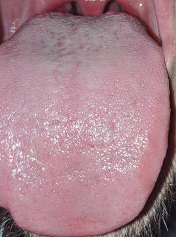 Rote Punkte Auf Der Zunge Gesundheit Und Medizin Gesundheit Rote Punkte Auf Der Zunge Gesundheit Und Medizin Gesundheit