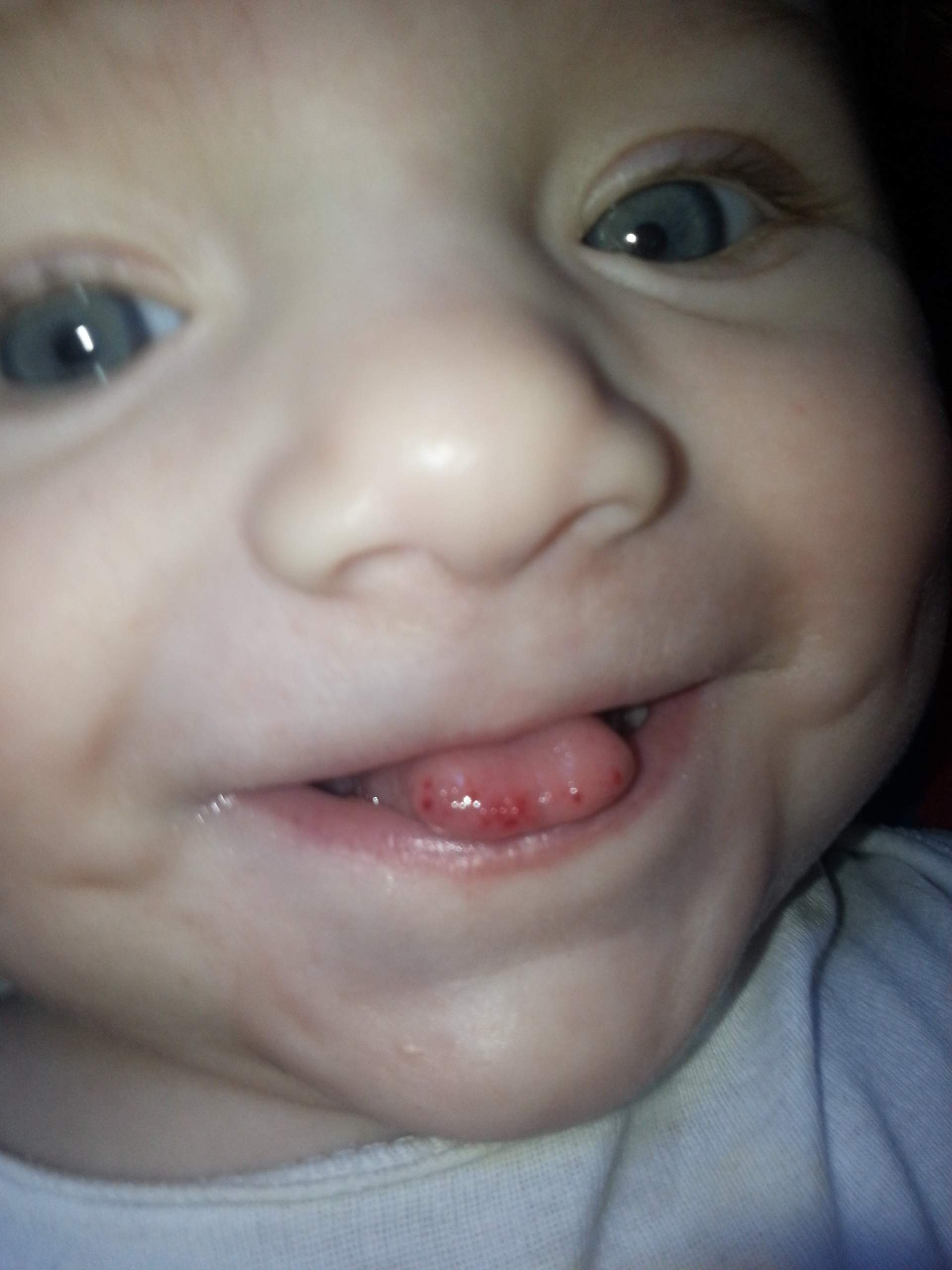 rote Punkte auf der zunge bei 5 Monate altem Baby? (Gesundheit)