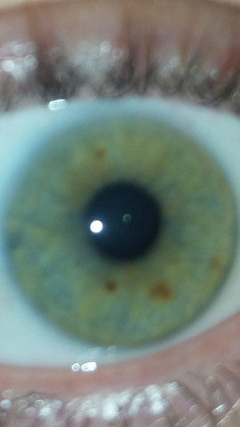 Mein Auge - (Medizin, Augen)