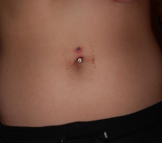 Piercing - (Piercing, Entzündung, Bauchnabelpiercing)