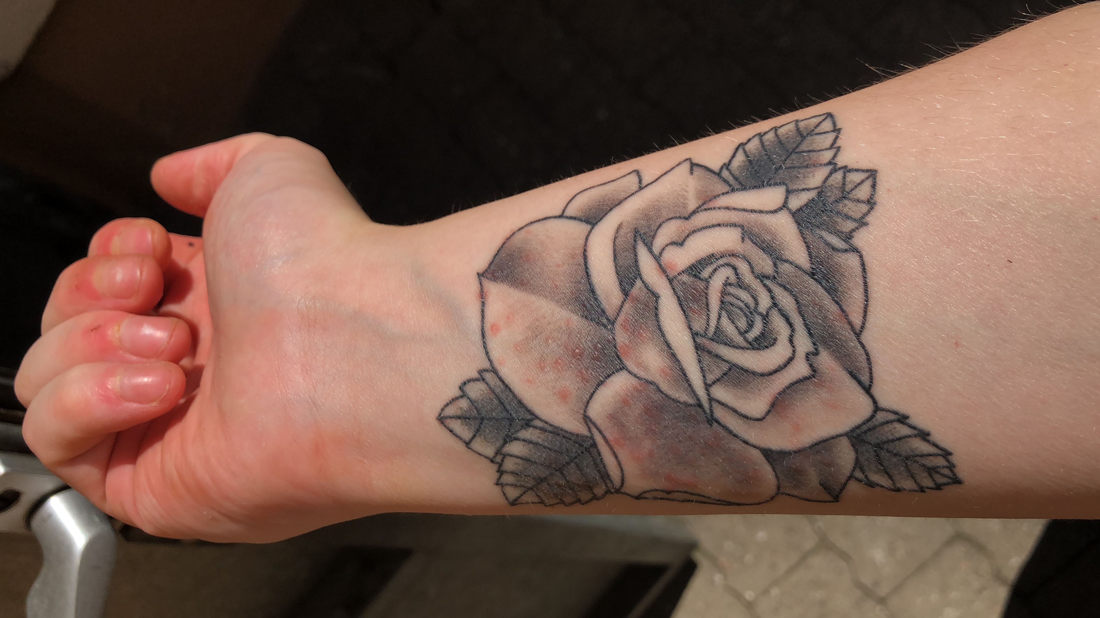 Rote Stellen Auf Dem Tattoo Was Konnte Es Sein Haut Schuppenflechte Tattoopflege