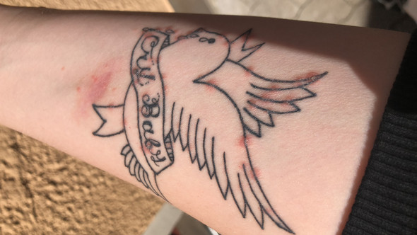 Rote Stellen Auf Dem Tattoo Was Konnte Es Sein Haut Schuppenflechte Tattoopflege