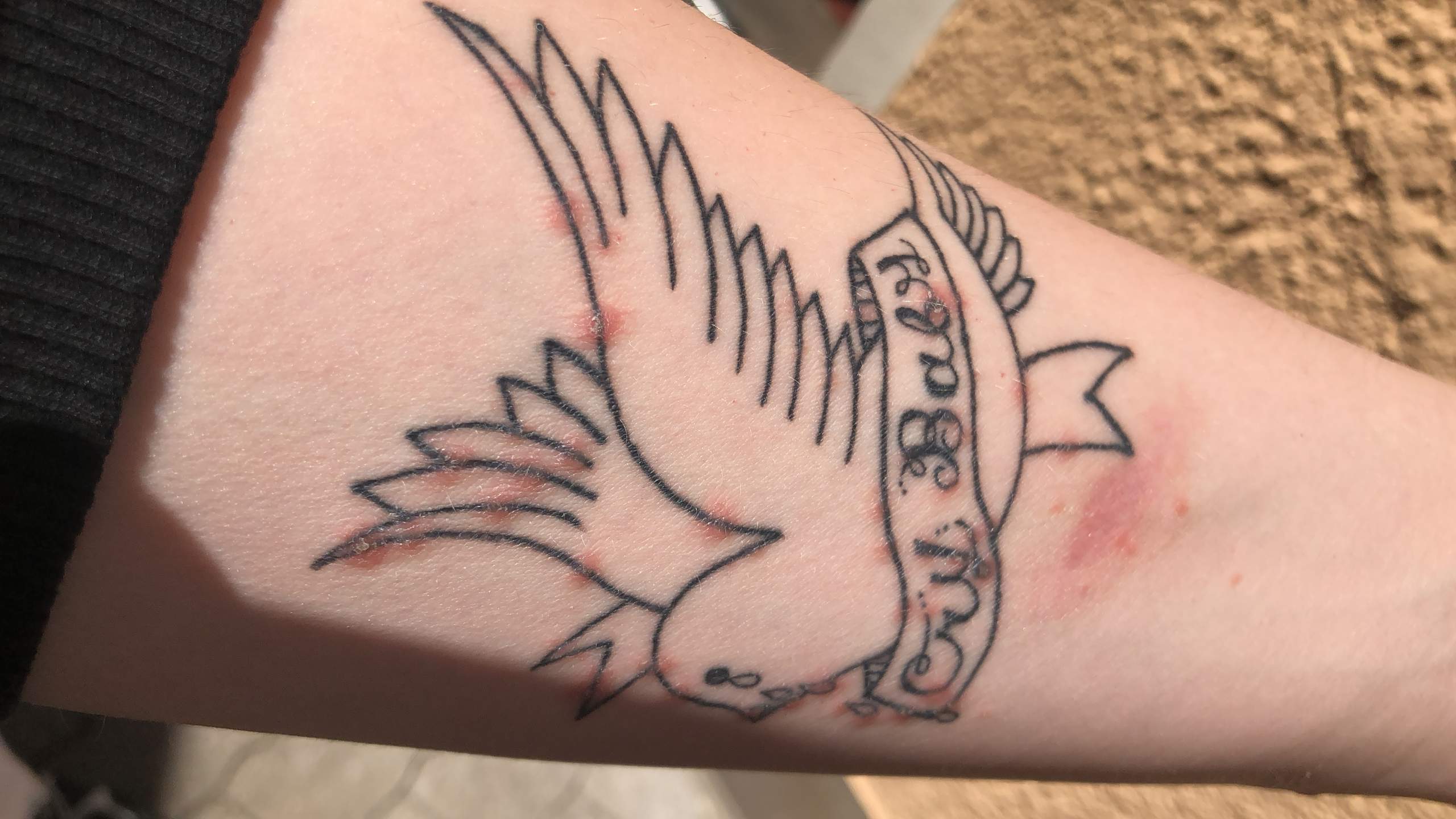 Rote stellen auf dem Tattoo, was könnte es sein? (Haut, Tattoopflege