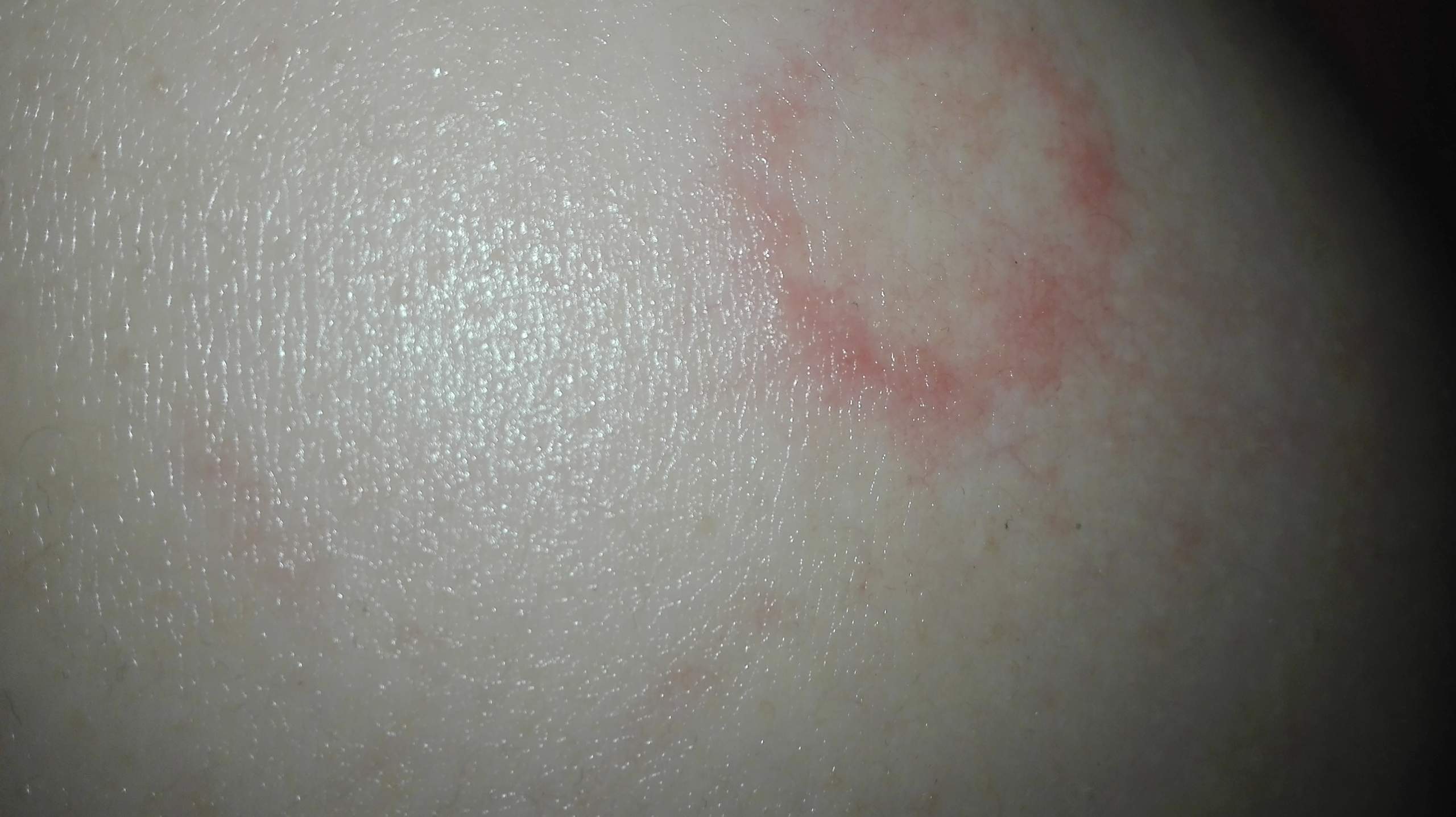 Roter Kreis am Rücken?