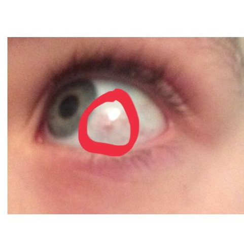  Dort sieht man nochmal ein Bild  - (Augen, Punkte, rot)