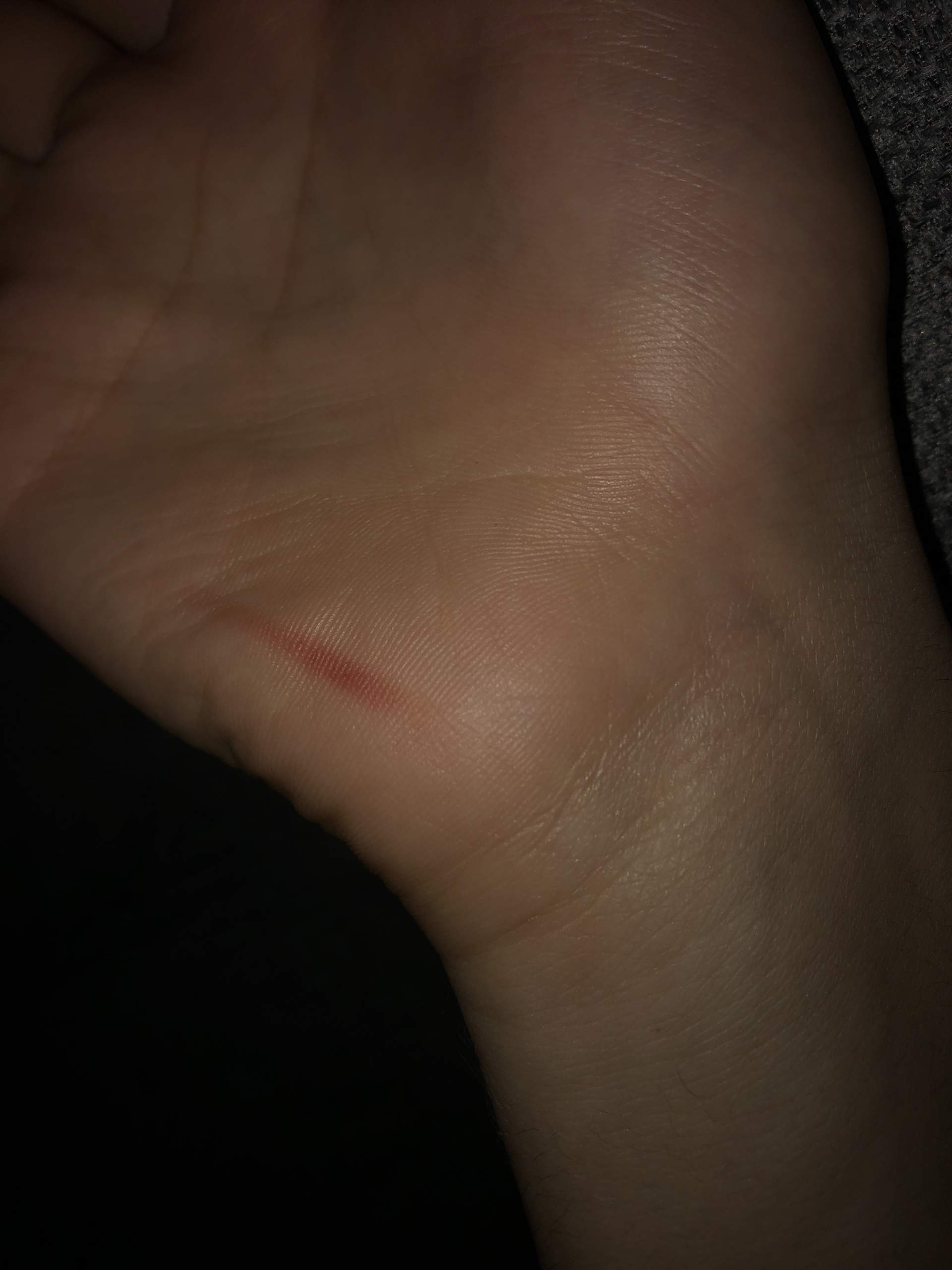 Roter Strich auf Handfläche? (Gesundheit und