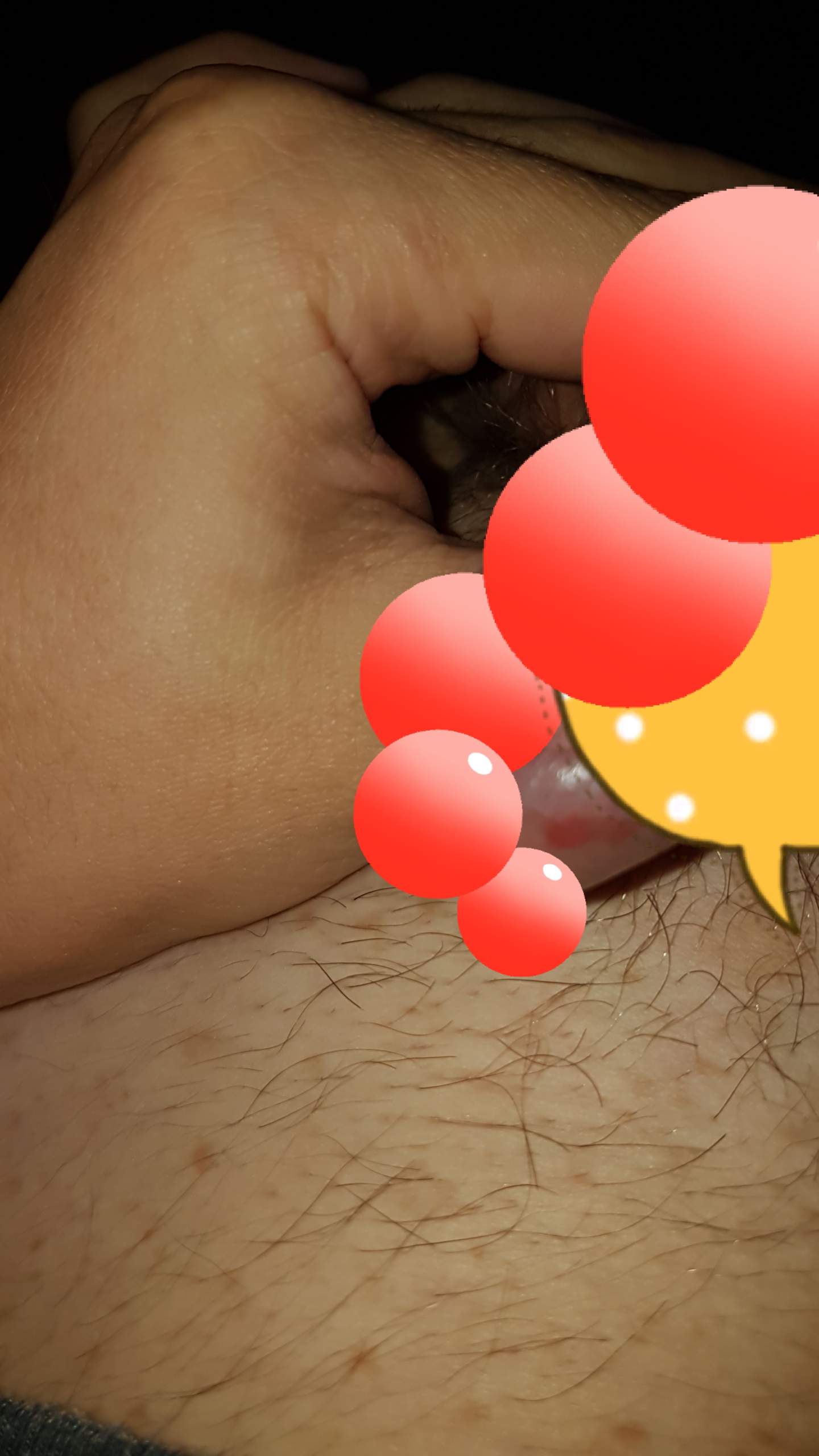 Rotes An Der Eichel Gesundheit Und Medizin Arzt Penis Rotes An Der Eichel Gesundheit Und Medizin Arzt Penis