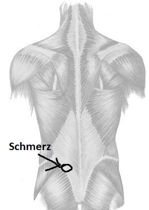 Rucken Schmerz Unten Links Bandscheiben Sport Ruckenschmerzen Bandscheibe Rucken Schmerz Unten Links Bandscheiben Sport Ruckenschmerzen Bandscheibe