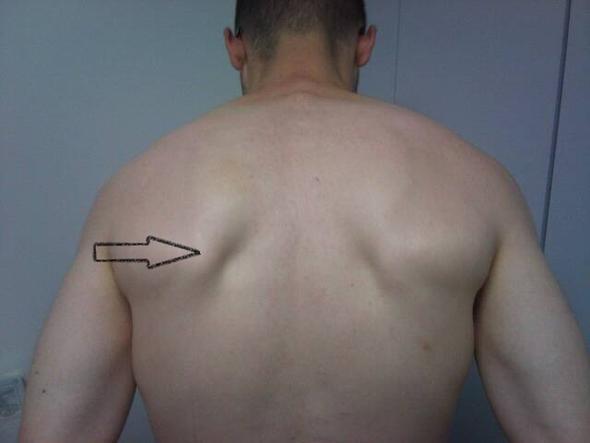 Mein Rücken - (Medizin, Krafttraining, Rücken)