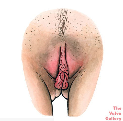 Schäme mich extrem für Aussehen meiner Vulva?