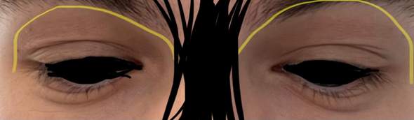 Schatten über den Augen, was machen?