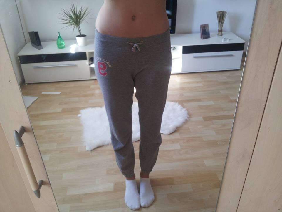 Schiefe Hüfte? (Körper)