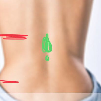Grüner Punkt = Buckel Roter Strich= Schmerz ab wann bis wo - (Gesundheit, Gesundheit und Medizin, Schmerzen)