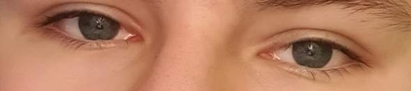 Schiele Ich Schielen Schielende Augen