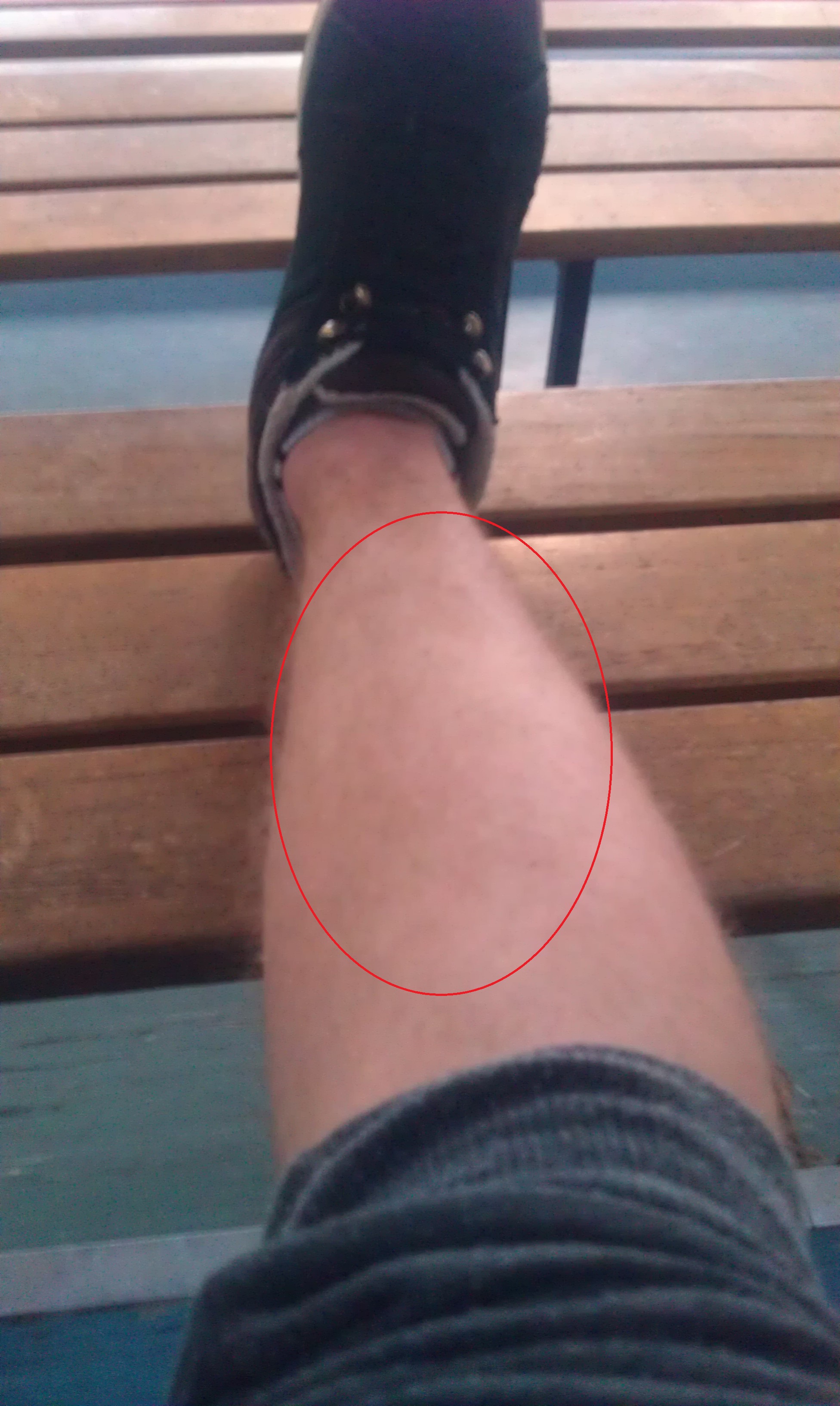 Schienbeinschmerzen nach Sportbetätigung (Sport, Schmerzen, Parkour)