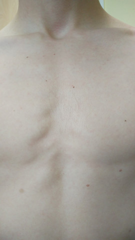 - (Gesundheit, Schmerzen, krank)