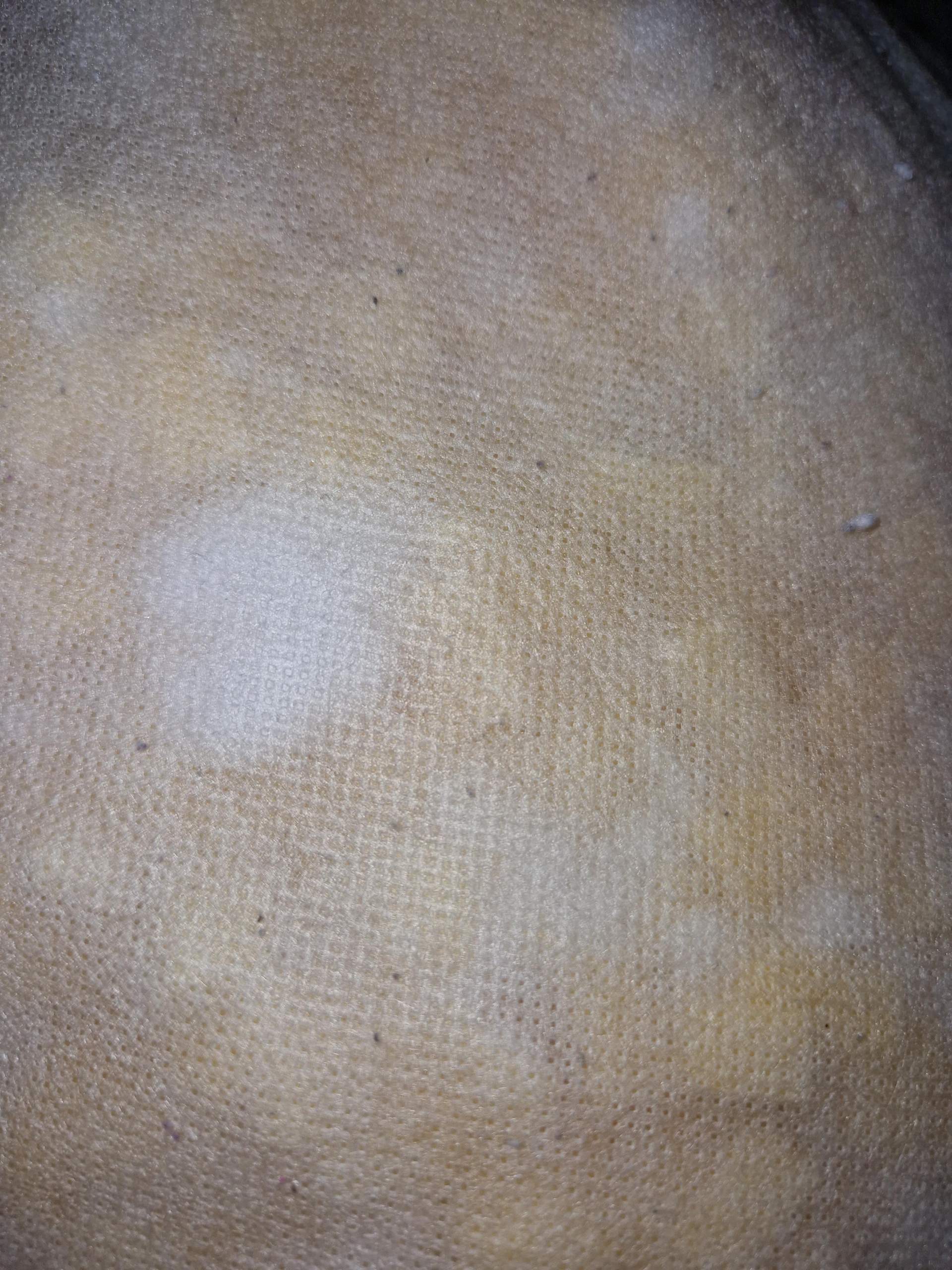 Schimmel oder Verfärbung Kopfkissen? (Hygiene, Flecken, Waschmaschine)