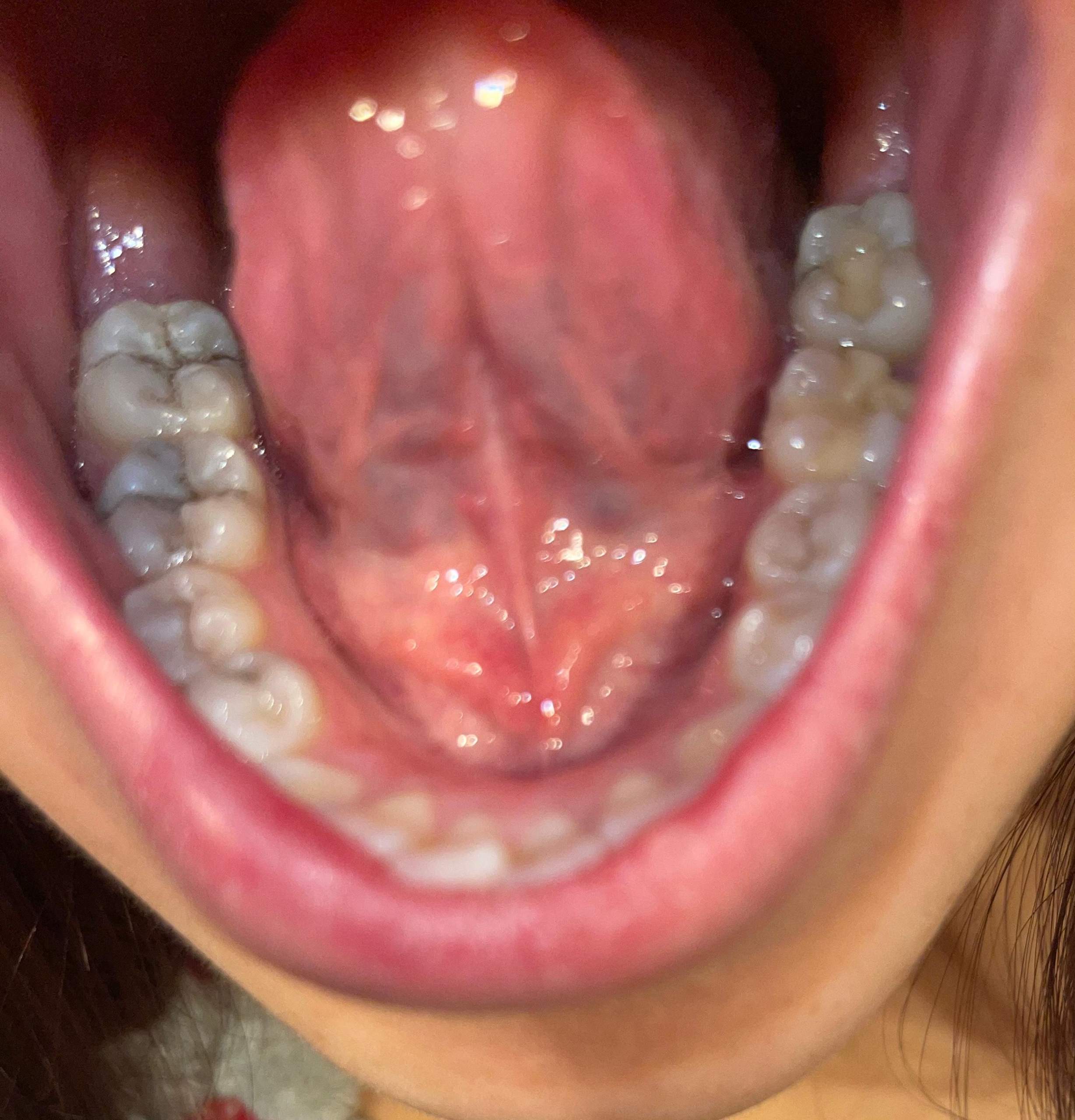 Schlechte Zähne mit 24? (Gesundheit, Angst, Zahnarzt)