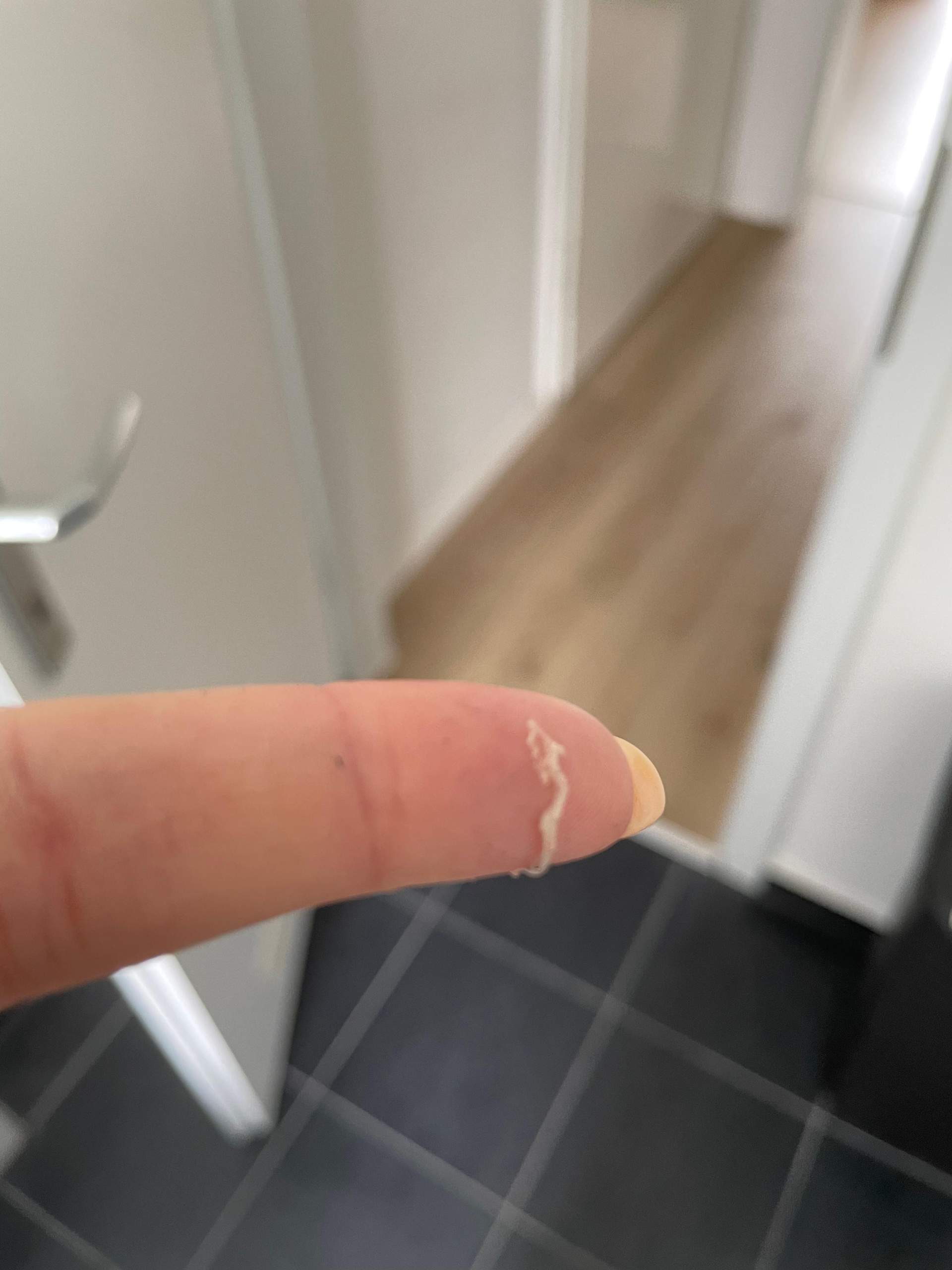 Weißer Schleim Im Auge Allergie