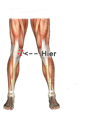 Schlimme Knie Schmerzen Was Konnte Das Sein Siehe Bild Danke Schlimme Knie Schmerzen Was Konnte Das Sein Siehe Bild Danke