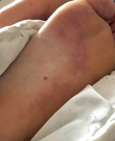 - (Gesundheit und Medizin, Krankheit, Fußgeruch)