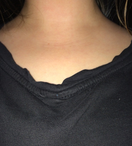 Schlusselbeine Attraktiv Schonheit Schlusselbein Schlusselbeine Attraktiv Schonheit Schlusselbein