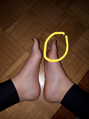 Grosser Zeh Die Meistgelesenen Fragen Grosser Zeh Die Meistgelesenen Fragen