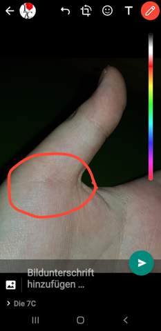 Schmerzen Am Daumen Was Tun Gesundheit Und Medizin Medizin Hand Schmerzen Am Daumen Was Tun Gesundheit Und Medizin Medizin Hand