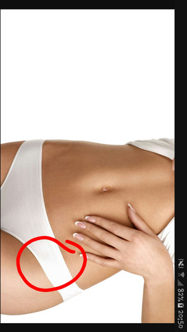 Schmerzen Am Linken Unterbauch Blinddarm Laufen Schmerzen Am Linken Unterbauch Blinddarm Laufen