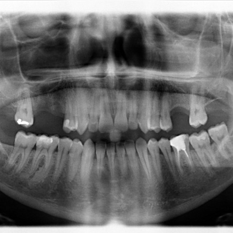 Röntgen
 - (Gesundheit und Medizin, Zahnarzt, Kiefer)
