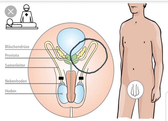 Schmerzen Am Samenleiter Gibt Es So Was Gesundheit Und Medizin Gesundheit Sex Schmerzen Am Samenleiter Gibt Es So Was Gesundheit Und Medizin Gesundheit Sex