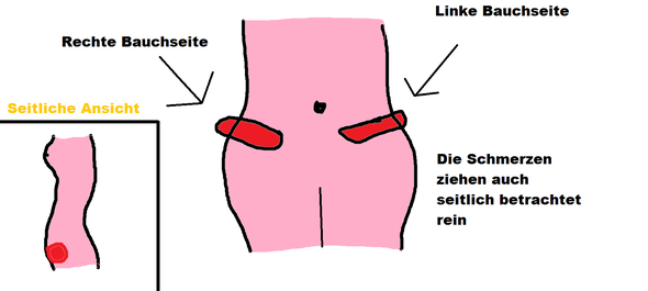 Seite linken auf bauch der stechen Schmerzen auf