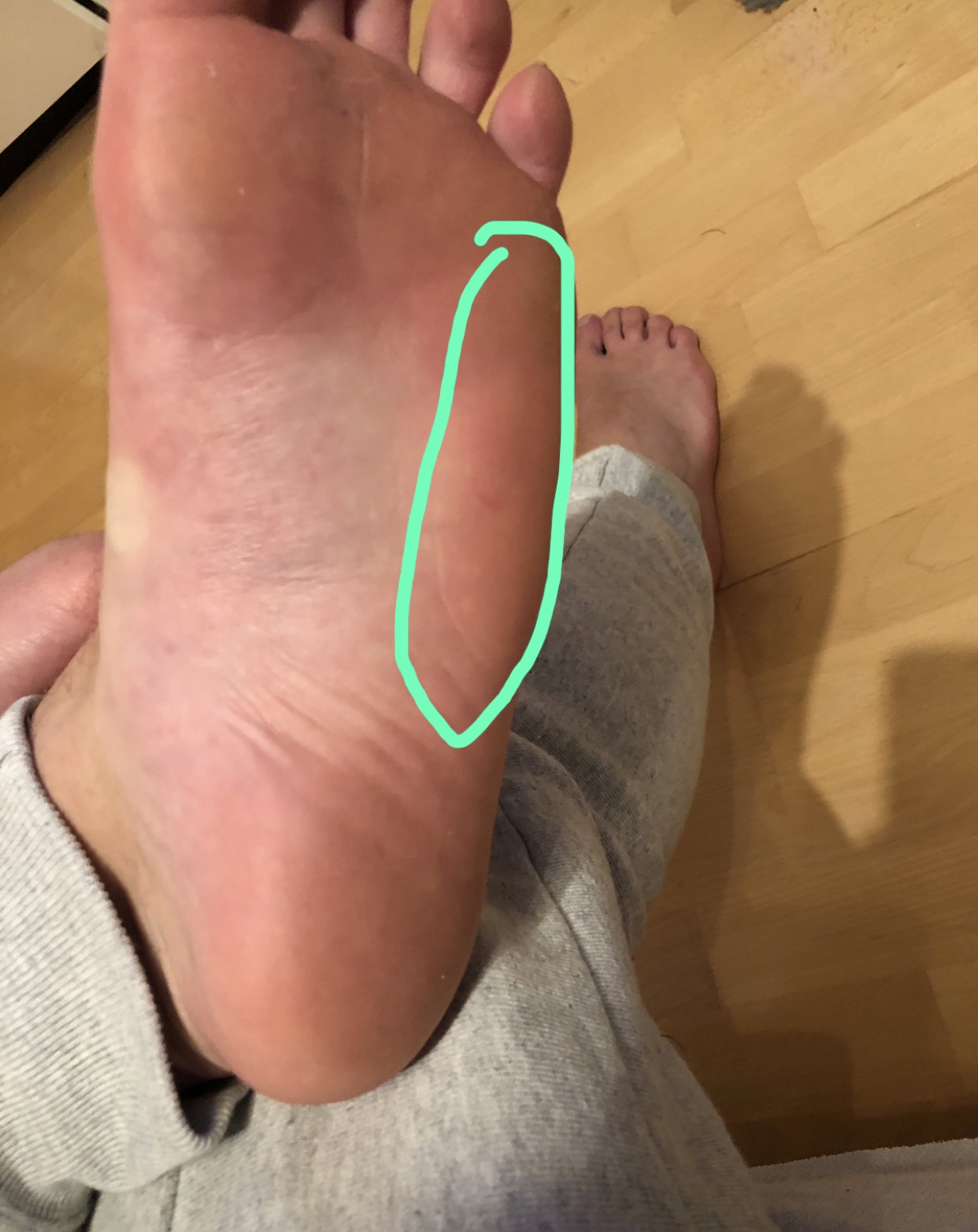 Schmerzen Beim Gehen Was Ist Das Gesundheit Und Medizin Stechender Schmerz Fusssohle Schmerzen Beim Gehen Was Ist Das Gesundheit Und Medizin Stechender Schmerz Fusssohle