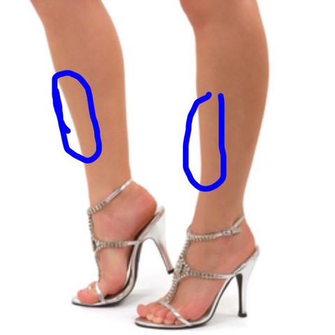 Schmerzen Im Bein Nach Dem Sport Fussball Beine Schienbein Schmerzen Im Bein Nach Dem Sport Fussball Beine Schienbein