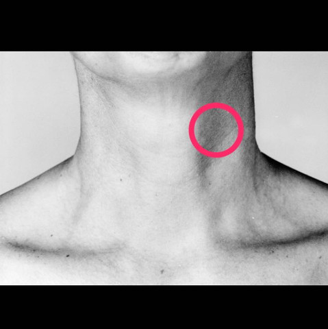 Schmerzen Im Hals Auf Der Linken Seite Beim Schlucken Gesundheit Korper Arzt Schmerzen Im Hals Auf Der Linken Seite Beim Schlucken Gesundheit Korper Arzt