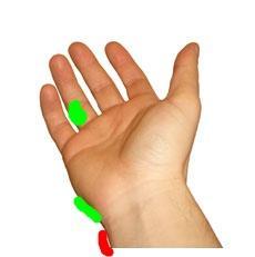 Schmerzen Im Handgelenk Aussen Arzt Weiss Nicht Weiter Krankenhaus Unfall Orthopadie Schmerzen Im Handgelenk Aussen Arzt Weiss Nicht Weiter Krankenhaus Unfall Orthopadie