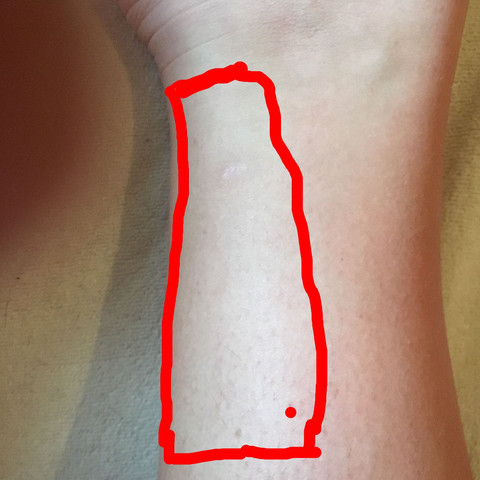 Schmerzen Im Rechten Bein Was Kann Das Sein Siehe Bild Arbeit Beine Schmerzen Im Rechten Bein Was Kann Das Sein Siehe Bild Arbeit Beine