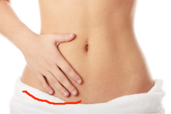 Schmerzen Im Unterleib Was Ist Das Bauch Schmerzen Im Unterleib Was Ist Das Bauch