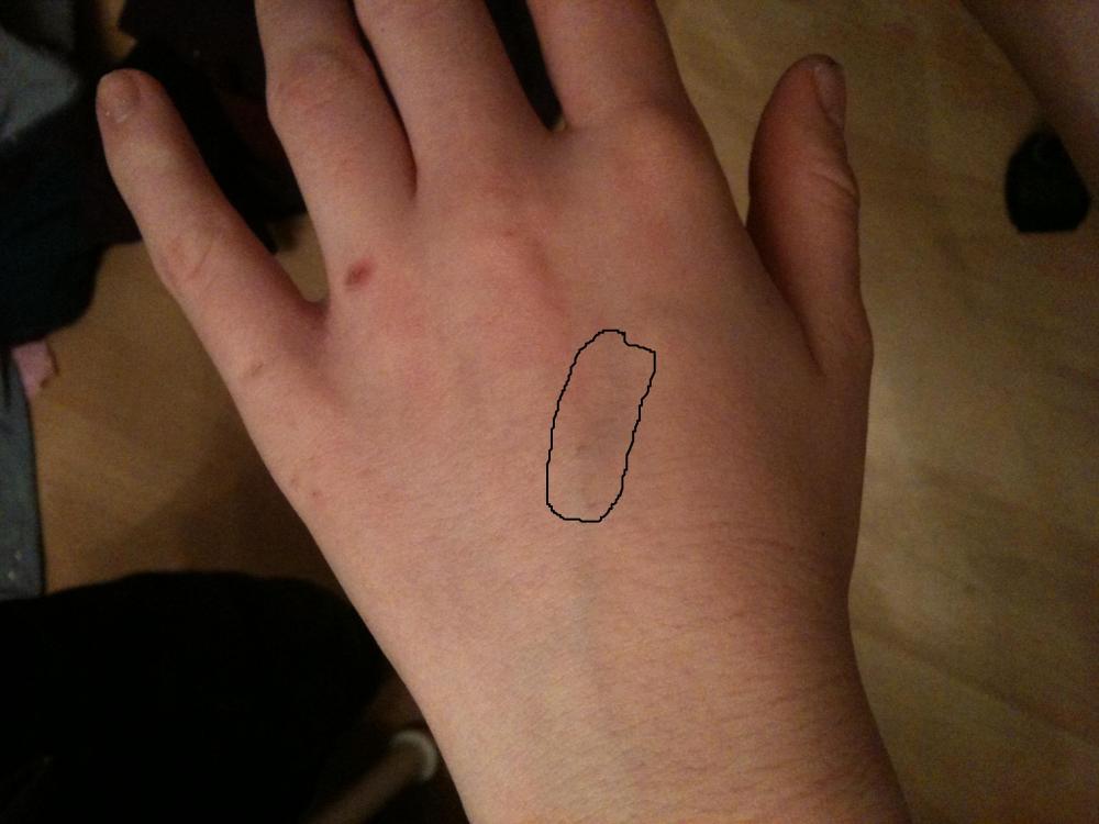 Schmerzen in der Ader (siehe Bild) (Gesundheit, Körper, Hand)