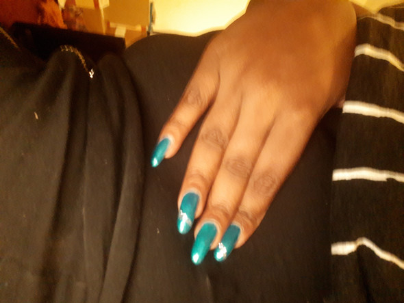 Schmerzen In Der Hufte Ziehen Und Leichtes Stechen Was Konnte Es Sein Und Was Hat Man Links Fur Organe Gesundheit Und Medizin Bauch Rucken Schmerzen In Der Hufte Ziehen Und Leichtes Stechen Was Konnte Es Sein Und Was Hat Man Links Fur Organe Gesundheit Und Medizin Bauch Rucken